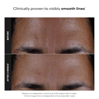 2% BHA Liquid Exfoliant